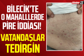 Bilecik’te Şimdi de Pire İddiası Vatandaşlar Tedirgin