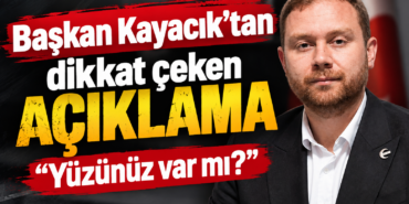 "Yüzünüz var mı?"